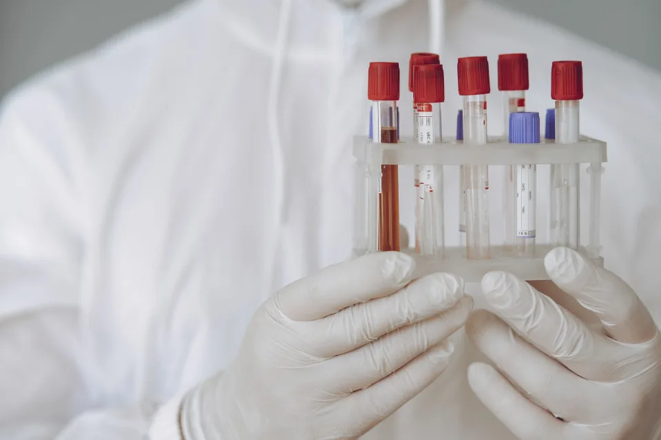 벨기에 보건당국, PFAS 혈액 검사 실효성에 대한 우려 제기 및 권고사항 발표