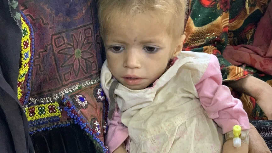 Afganistan'da 3,7 milyon çocuk yetersiz beslenmeyle mücadele ediyor